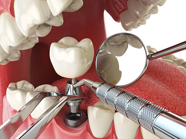 Best Emergency Treatment for Oral Infections in Mayville, ND